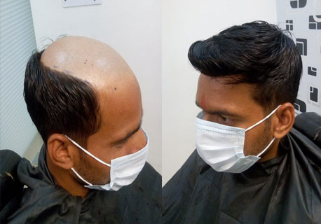 Hair Fixing