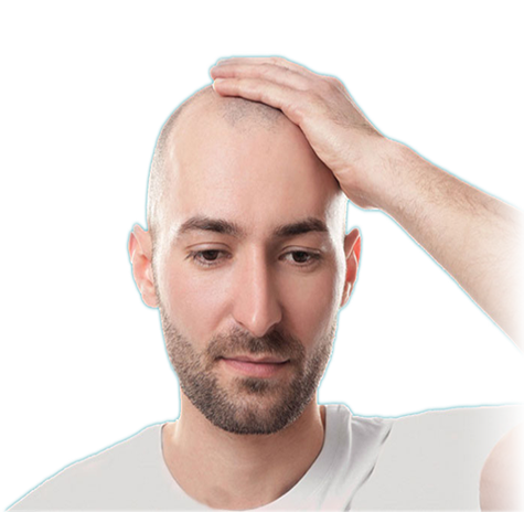 Hair Replacement Service